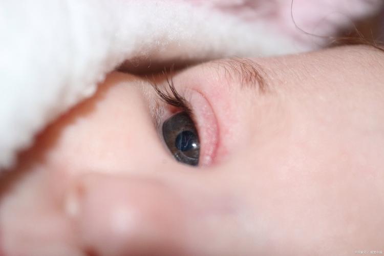 新生儿瞳孔周围出现一圈环状物是正常生理现象还是异常信号?-第1张图片-郑州医学网 新生儿瞳孔周围出现一圈环状物是正常生理现象还是异常信号?-第1张图片-郑州医学网