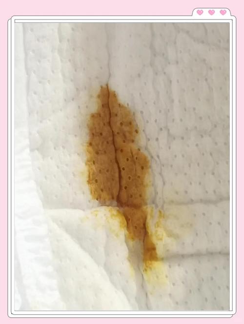 新生儿没大便一直放屁-第3张图片-郑州医学网