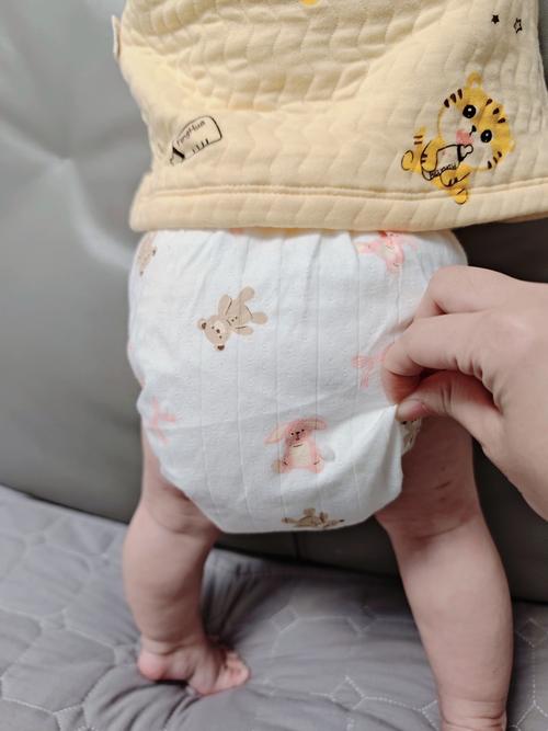 新生儿尿布怎么选？棉柔、纸尿裤、布尿布哪种更适合宝宝娇嫩肌肤？-第2张图片-郑州医学网