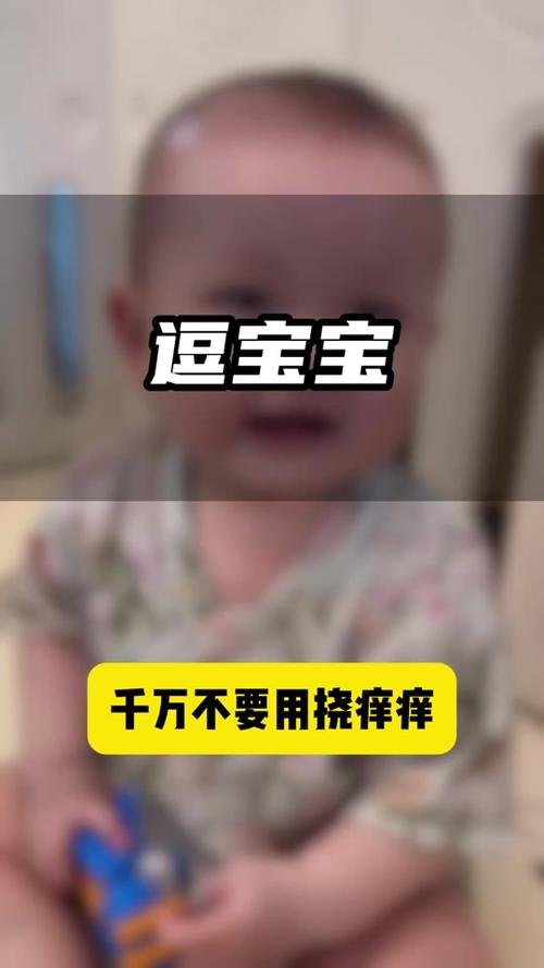 新生儿皮肤娇嫩，挠痒痒真的安全吗？会不会有隐藏风险？-第2张图片-郑州医学网