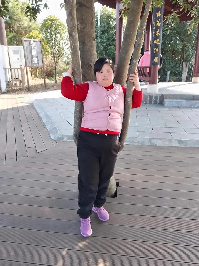 唐氏综合症新生儿有哪些典型表现？如何早期识别与干预？-第1张图片-郑州医学网