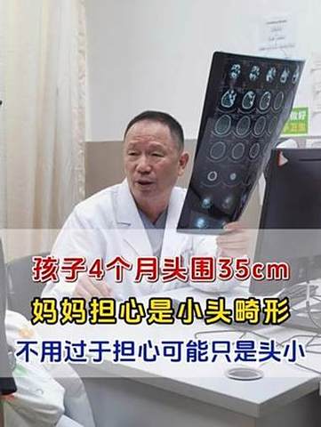 孕期如何及时发现小头畸形?产检能排查出胎儿头围异常吗?-第2张图片-郑州医学网 孕期如何及时发现小头畸形?产检能排查出胎儿头围异常吗?-第2张图片-郑州医学网