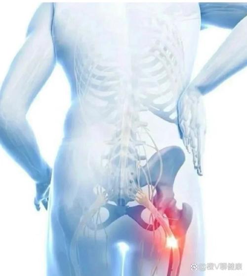 孕期右边屁股疼得厉害,是胎儿压迫还是身体出问题了?-第1张图片-郑州医学网 孕期右边屁股疼得厉害,是胎儿压迫还是身体出问题了?-第1张图片-郑州医学网