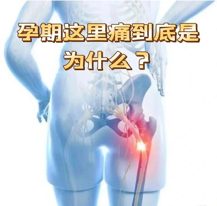 孕期右边屁股疼得厉害,是胎儿压迫还是身体出问题了?-第2张图片-郑州医学网 孕期右边屁股疼得厉害,是胎儿压迫还是身体出问题了?-第2张图片-郑州医学网