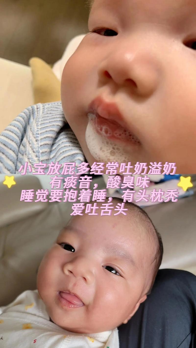 新生儿吐奶是正常现象吗？需要担心哪些异常情况？-第2张图片-郑州医学网