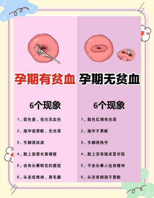 孕期贫血会对宝宝健康造成哪些潜在影响？-第3张图片-郑州医学网