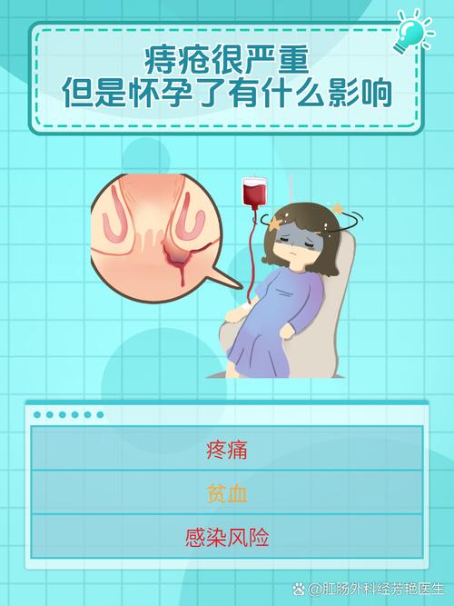 孕期痔疮高发，究竟是什么原因在捣鬼？-第2张图片-郑州医学网