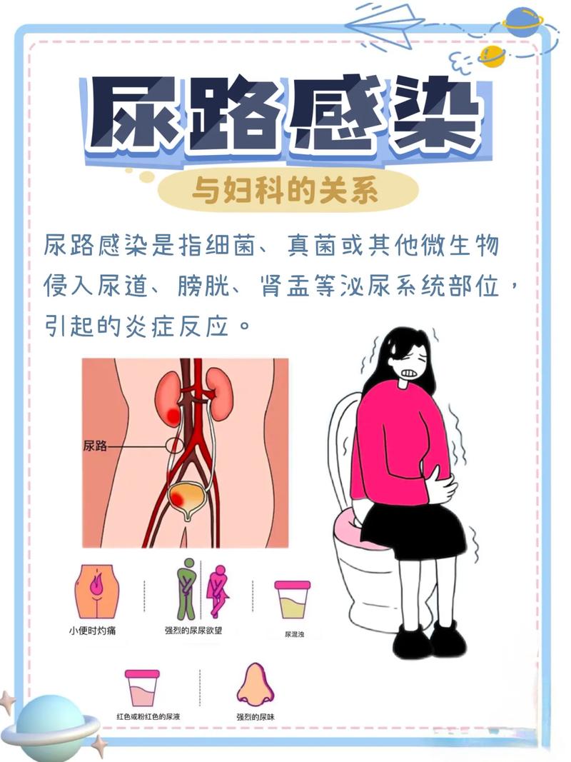 孕期尿路感染有哪些典型症状？需警惕哪些异常信号？-第1张图片-郑州医学网