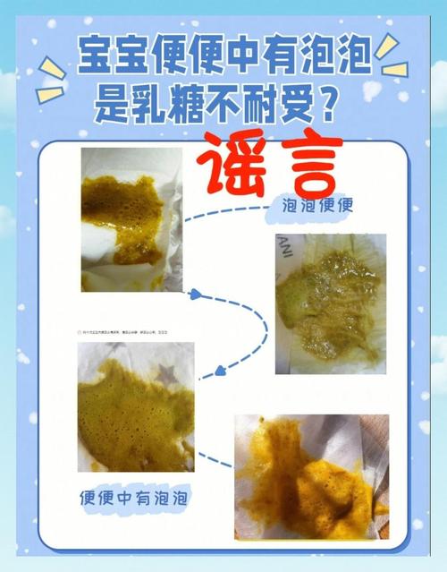 新生儿拉屎像水样是腹泻吗？需要就医吗？怎么办？-第2张图片-郑州医学网
