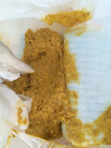 新生儿宝宝5天没大便，是攒肚还是便秘？需要立即就医吗？-第1张图片-郑州医学网