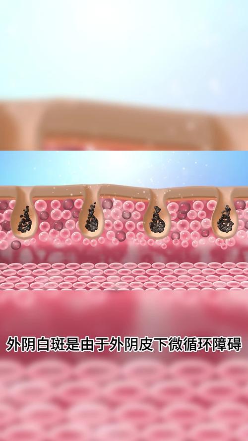 孕期阴唇变大是正常生理变化还是异常信号？需警惕哪些潜在风险？-第2张图片-郑州医学网