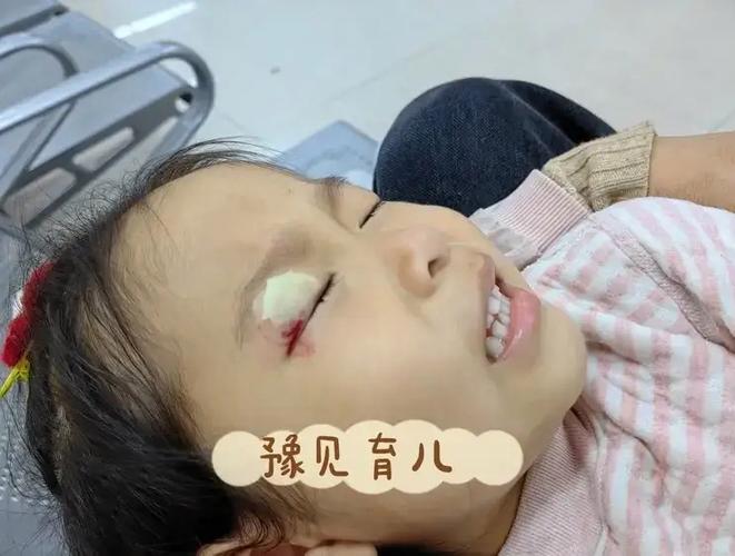 孕期宝宝眼睛发育不良，是哪些因素在悄悄影响？-第1张图片-郑州医学网