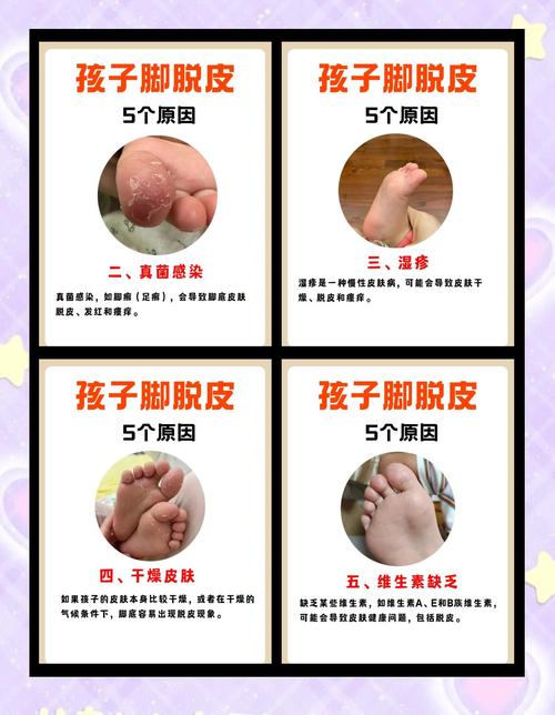 新生儿蜕皮是正常生理现象还是皮肤疾病信号？需如何科学护理？-第1张图片-郑州医学网