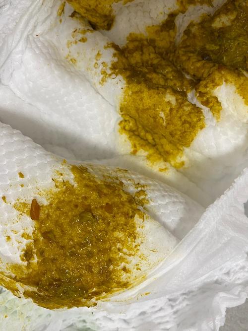 新生儿吐奶吐出黄色奶是消化不良还是病理信号？-第2张图片-郑州医学网