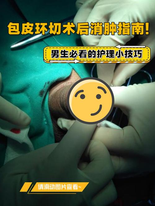 儿童包皮手术后恢复过程图解，不同阶段伤口变化该如何观察护理？-第1张图片-郑州医学网