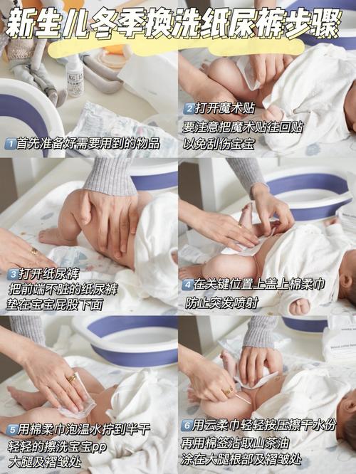 新生儿换尿布湿时有哪些注意事项？新手爸妈如何正确操作避免宝宝不适？-第2张图片-郑州医学网