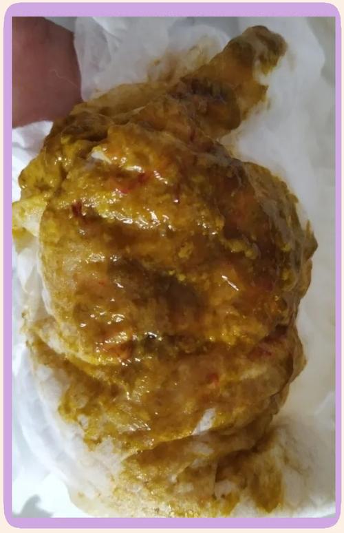 5天新生儿大便带血丝是何原因？需要立即就医吗？-第2张图片-郑州医学网