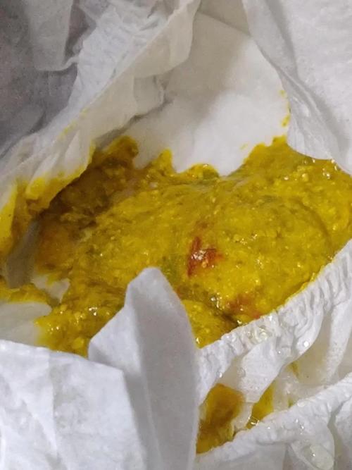 5天新生儿大便带血丝是何原因？需要立即就医吗？-第3张图片-郑州医学网