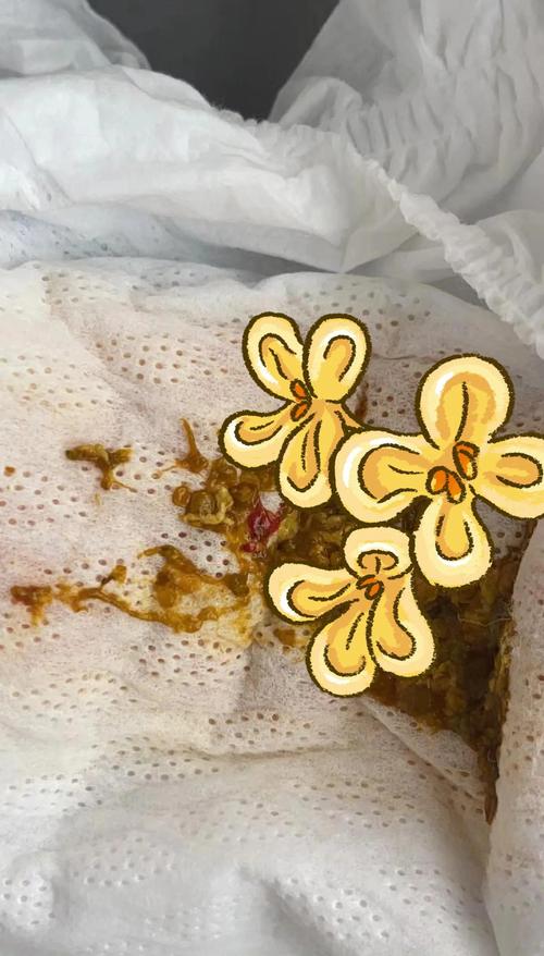 5天新生儿大便带血丝是何原因？需要立即就医吗？-第1张图片-郑州医学网