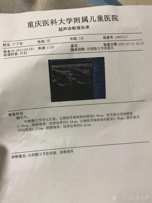 儿童髋关节滑膜炎的病因、症状与治疗方案有哪些关键点?-第2张图片-郑州医学网 儿童髋关节滑膜炎的病因、症状与治疗方案有哪些关键点?-第2张图片-郑州医学网