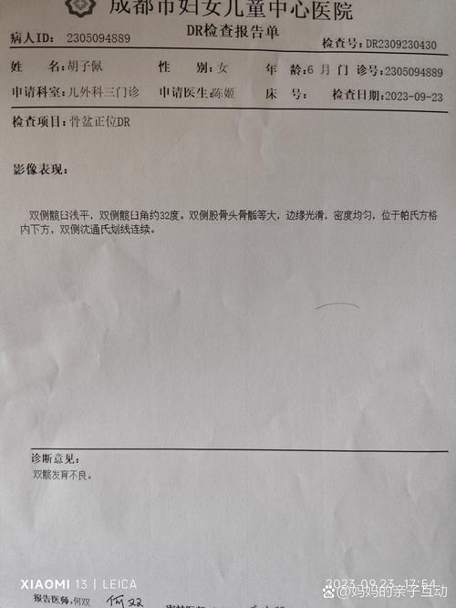 儿童髋关节滑膜炎的病因、症状与治疗方案有哪些关键点?-第3张图片-郑州医学网 儿童髋关节滑膜炎的病因、症状与治疗方案有哪些关键点?-第3张图片-郑州医学网