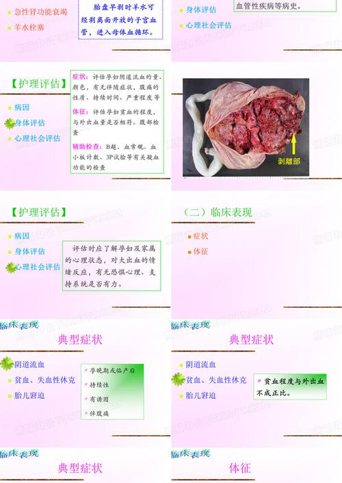 胎盘早剥究竟会对新生儿造成哪些不可逆的伤害？-第1张图片-郑州医学网