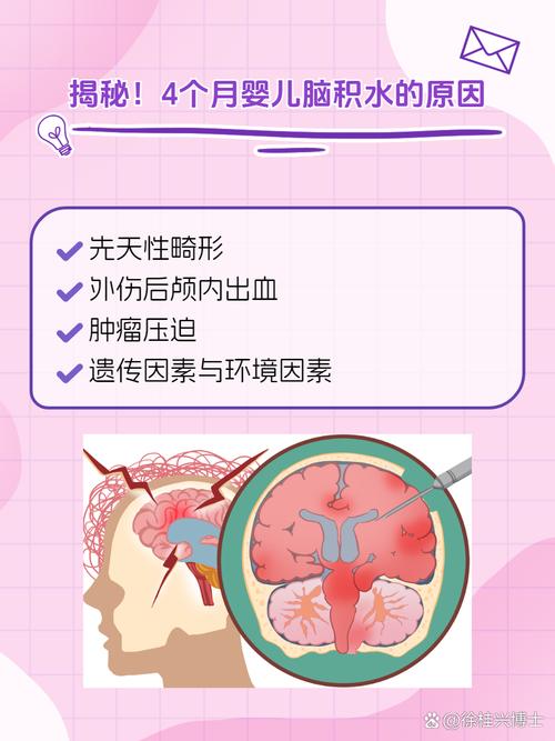 新生儿脑积液能治好吗？治疗方式有哪些？预后会影响发育吗？-第1张图片-郑州医学网