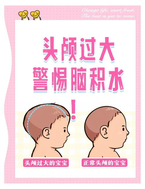 新生儿脑积液能治好吗？治疗方式有哪些？预后会影响发育吗？-第3张图片-郑州医学网