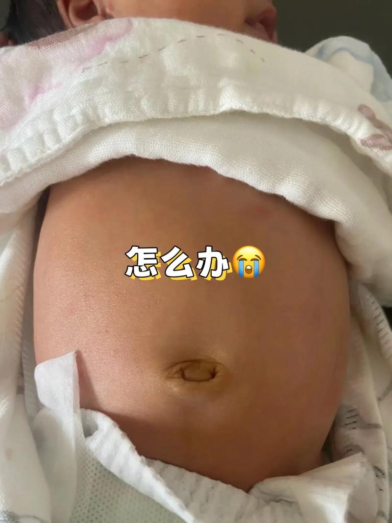 新生儿肚子鼓鼓是正常现象吗？需要担心哪些健康问题？-第2张图片-郑州医学网