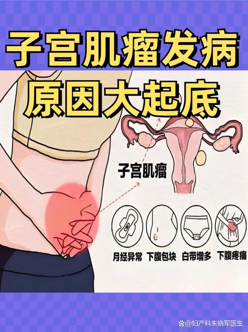 孕期子宫肌瘤真能预示胎儿性别？男孩概率更高有科学依据吗？-第3张图片-郑州医学网