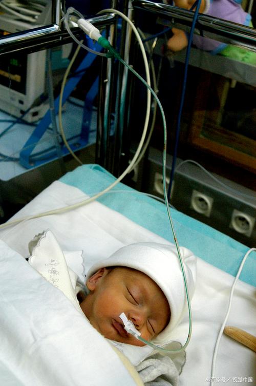 新生儿重度缺氧后遗症能否早期干预减轻脑损伤程度？-第1张图片-郑州医学网