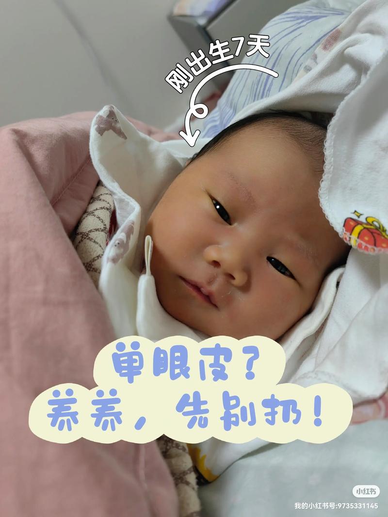 新生儿双眼皮是天生注定还是后天变化?如何科学判断其是否会定型?-第3张图片-郑州医学网 新生儿双眼皮是天生注定还是后天变化?如何科学判断其是否会定型?-第3张图片-郑州医学网