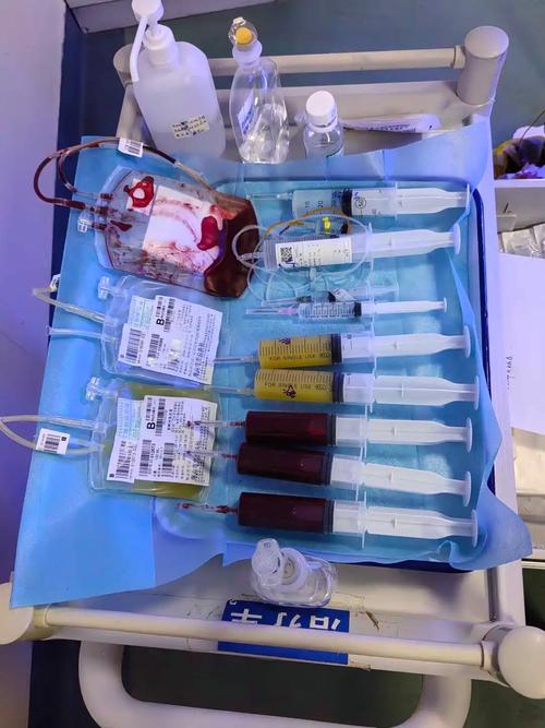 新生儿换血治疗究竟是什么?为何需要这种高风险操作?-第1张图片-郑州医学网 新生儿换血治疗究竟是什么?为何需要这种高风险操作?-第1张图片-郑州医学网