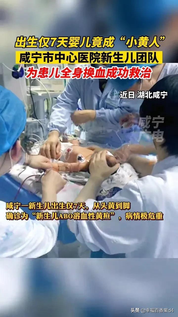 新生儿换血治疗究竟是什么？为何需要这种高风险操作？-第3张图片-郑州医学网