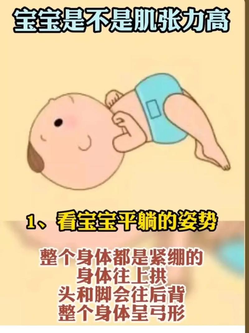 新生儿肌张力异常有哪些表现？家长该如何判断和处理？-第2张图片-郑州医学网