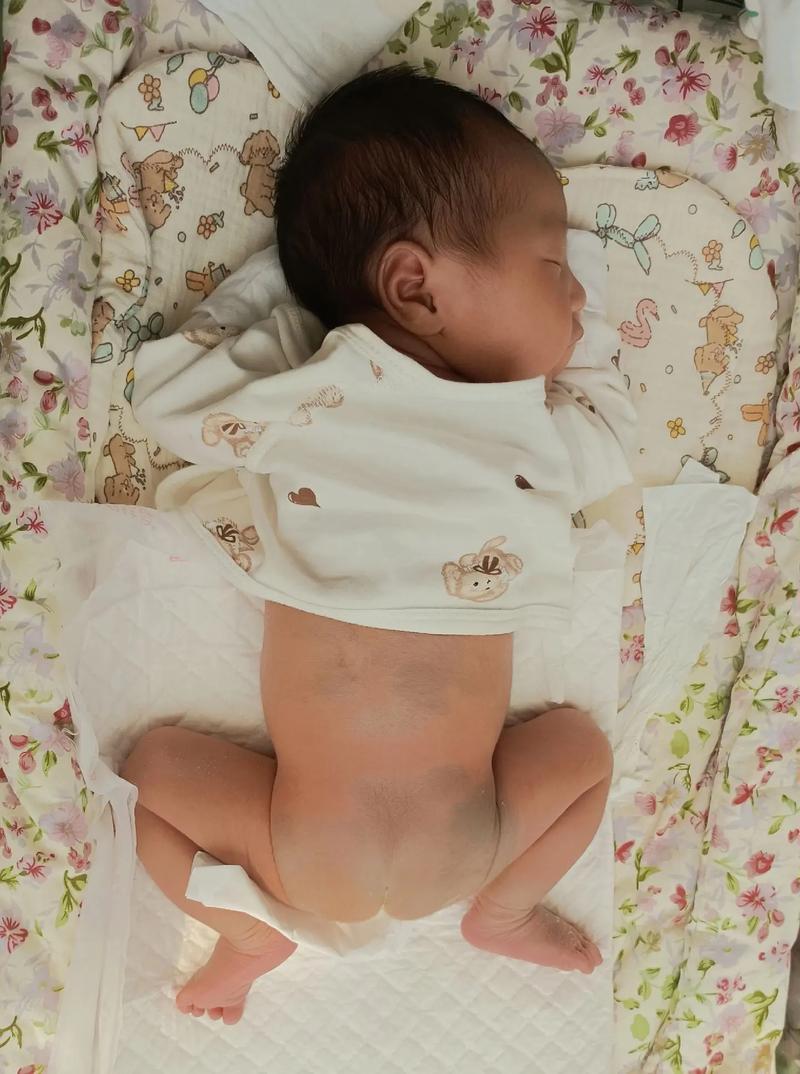 新生儿皮肤为何会呈现青紫色？这正常吗？背后的生理机制是什么？-第1张图片-郑州医学网