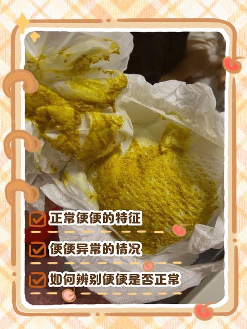 新生儿大便异常图片如何辨别？这些情况必须警惕！-第2张图片-郑州医学网