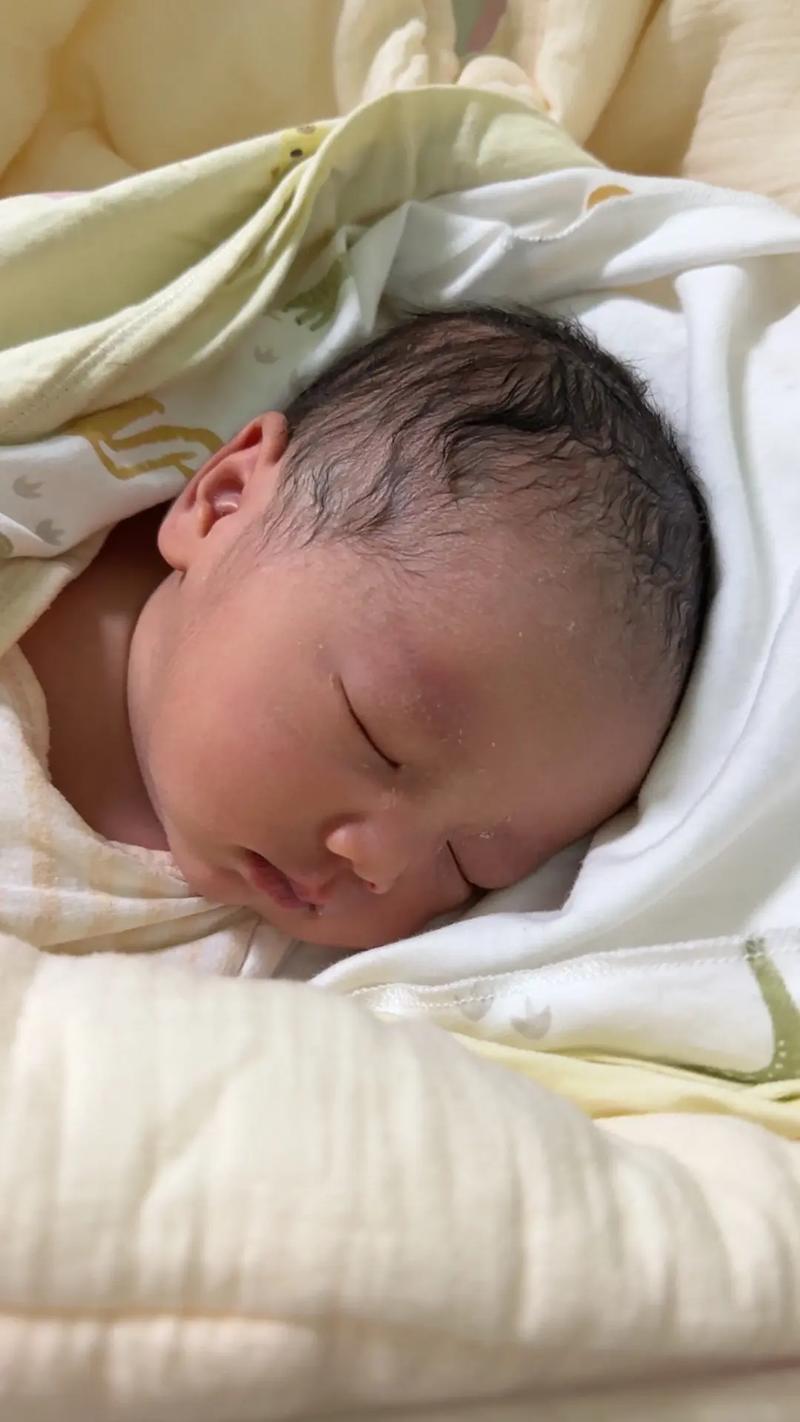 新生儿快满月脸发黄是正常生理现象还是需要就医的信号？-第3张图片-郑州医学网