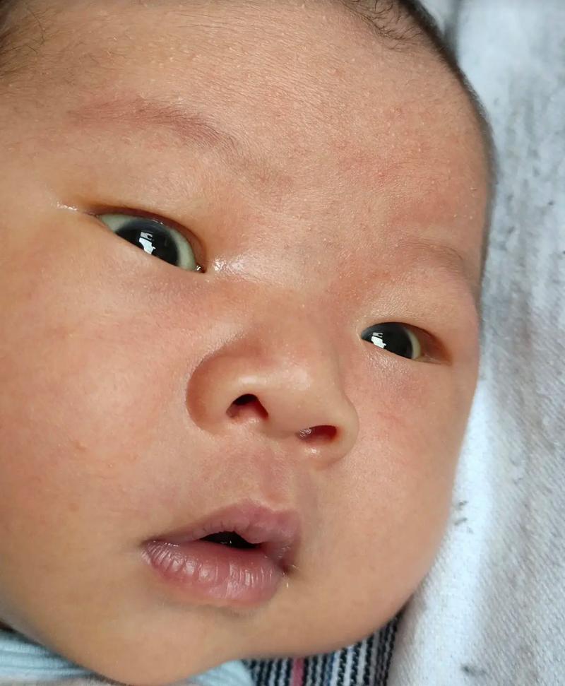 新生儿快满月脸发黄是正常生理现象还是需要就医的信号？-第2张图片-郑州医学网