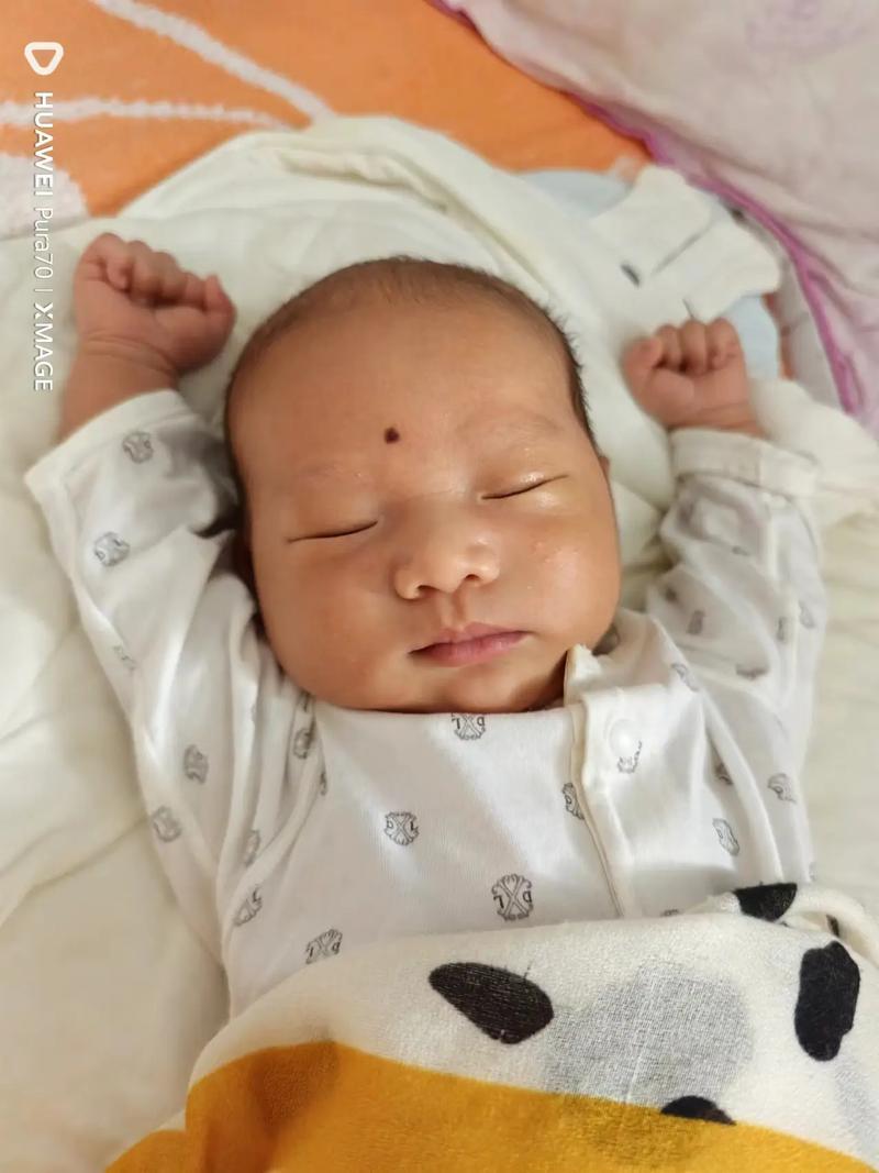 新生儿快满月脸发黄是正常生理现象还是需要就医的信号？-第1张图片-郑州医学网