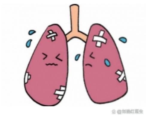 新生儿肺出血的致命风险究竟源自哪些生理机制与诱因？-第1张图片-郑州医学网