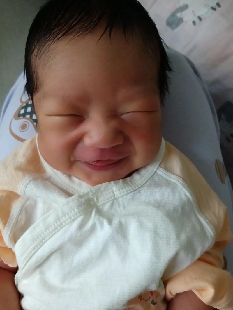 新生儿黄疸在家怎么测？这些方法和注意事项家长必须知道！-第1张图片-郑州医学网