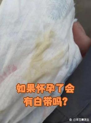 易孕期正常白带图片是什么样子？颜色、质地变化如何区分异常？-第2张图片-郑州医学网