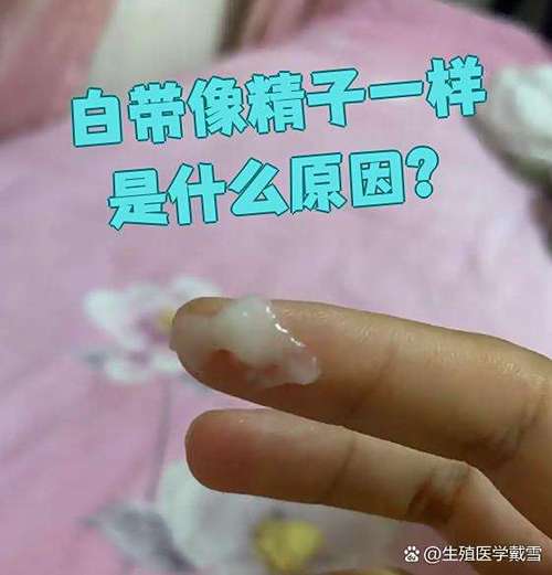 易孕期正常白带图片是什么样子？颜色、质地变化如何区分异常？-第1张图片-郑州医学网
