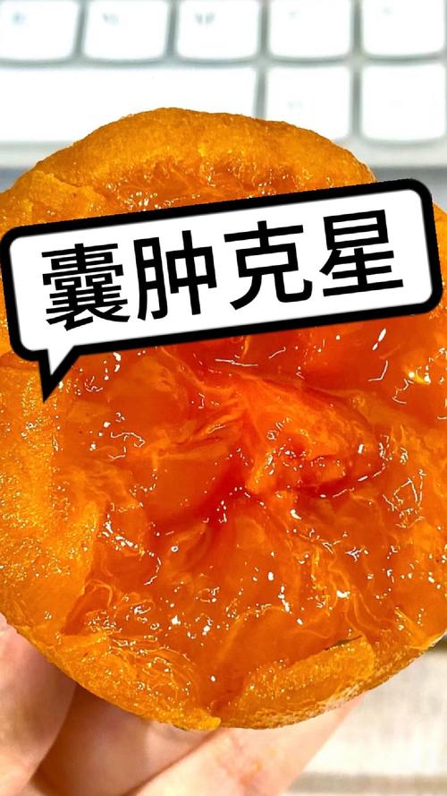 孕期囊肿患者该如何科学饮食？哪些食物能帮助缓解囊肿症状？-第2张图片-郑州医学网