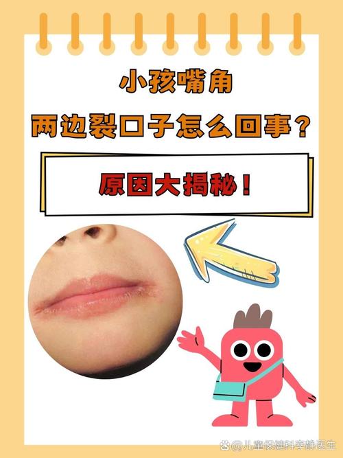 儿童嘴巴干裂是缺水还是生病了？家长该如何正确护理？-第1张图片-郑州医学网