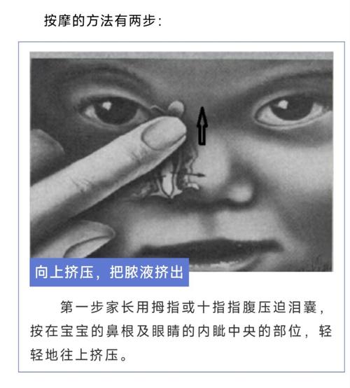 新生儿泪囊炎按摩视频能自学吗？操作不当会伤到眼睛吗？-第1张图片-郑州医学网