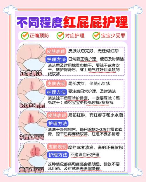 新生儿红屁股是哪些原因导致的？如何有效预防和护理？-第1张图片-郑州医学网