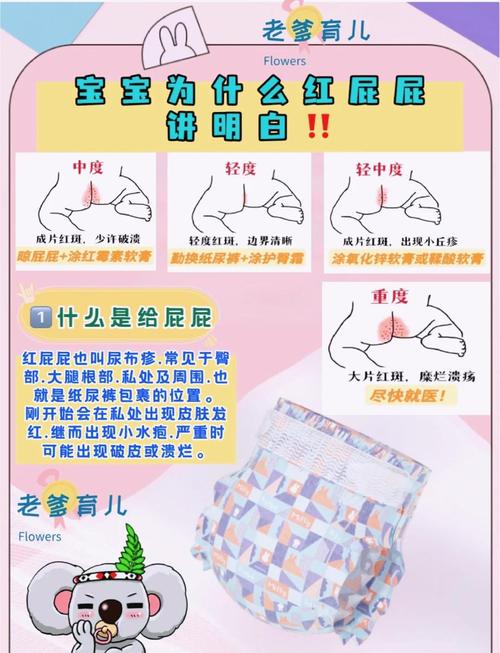 新生儿红屁股是哪些原因导致的？如何有效预防和护理？-第2张图片-郑州医学网