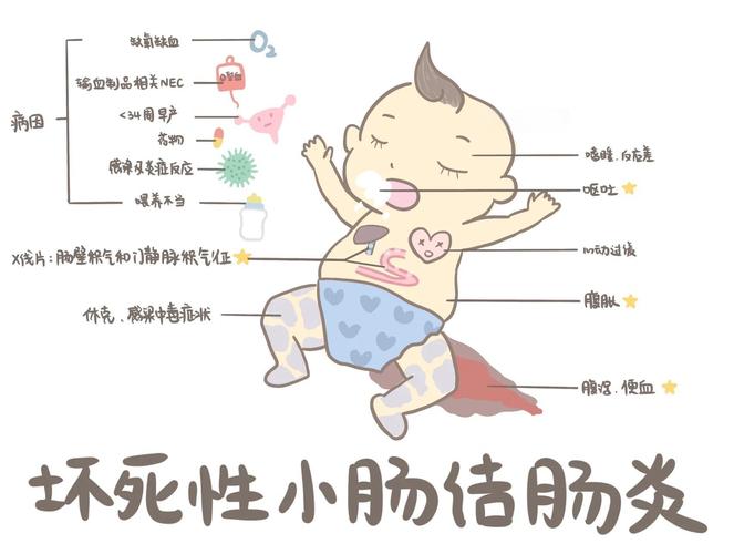 新生儿结肠炎有哪些有效治疗方法？如何根据病情选择最佳方案？-第2张图片-郑州医学网